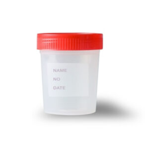 Ουροδοχείο Με Πώμα - 120ml